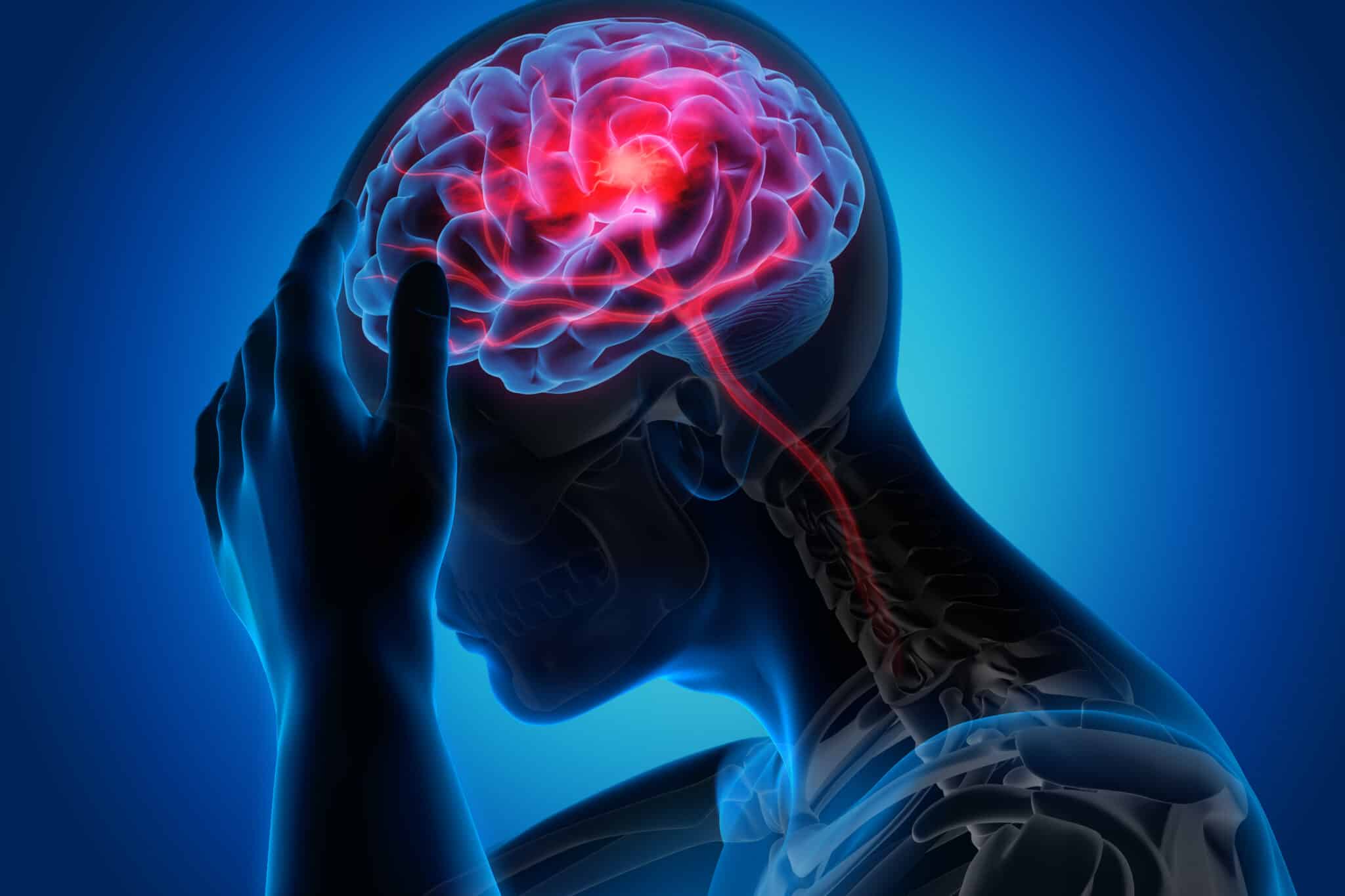 The Symptoms of a Mild TBI After a Accident in Texas