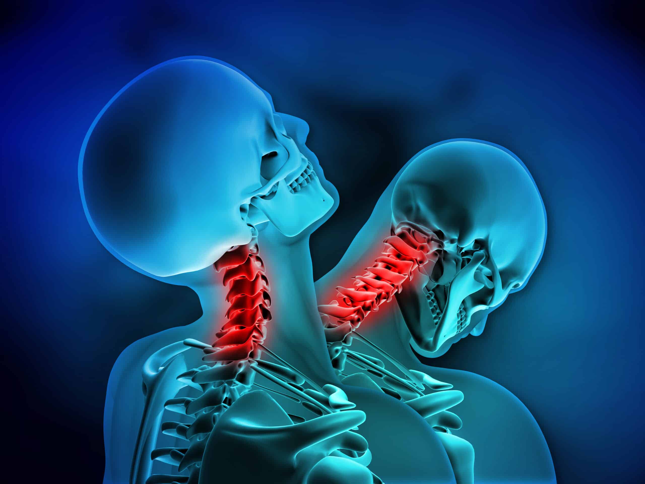 Did You Experience Whiplash in a Corpus Christi Car Accident or Is it More Serious?