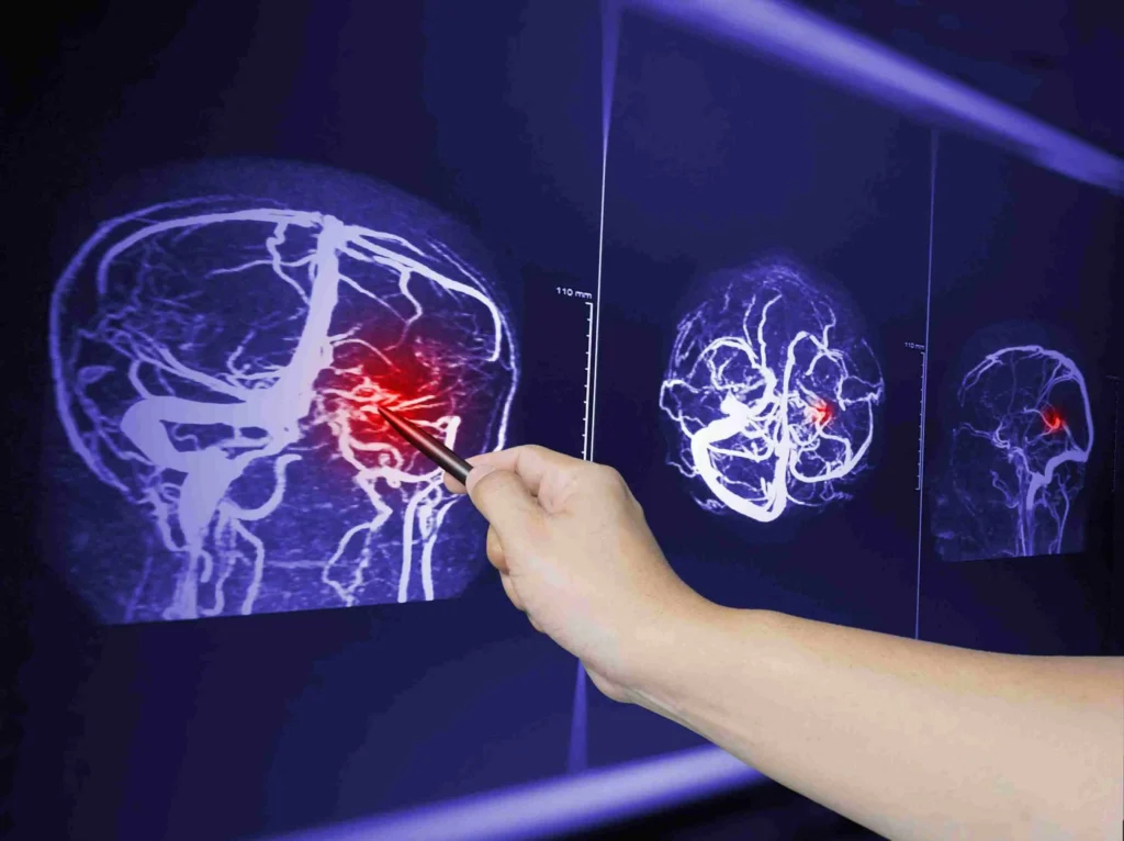 How to Find the Best Brain Injury Attorney in Corpus Christi scaled